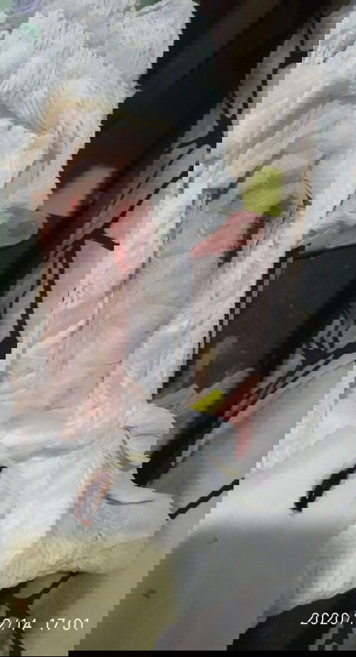 Normal bang duguin matapos ang IE?