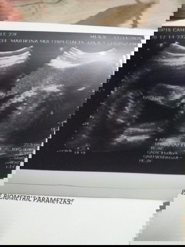 Yehey baby girl☺️ tama po ba? Excited nako mga mommy☺️