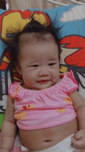 น้องไม่ถ่ายมา 3 วันละค่ะ ทำไงดี