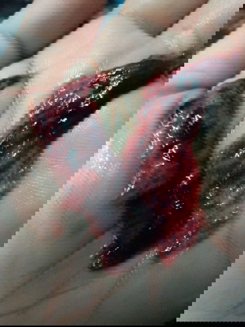 ตรวจหมอบอกว่าตั้งท้อง