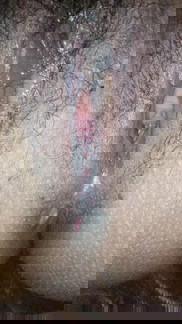 Vaginal cut