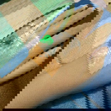 menjelang operasi SC