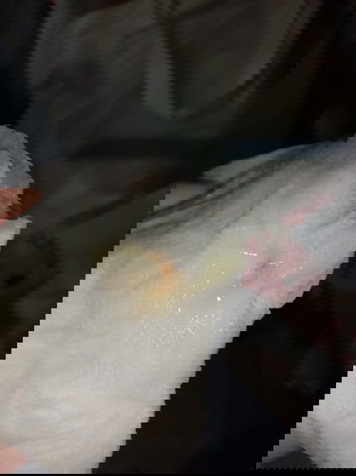 กระตุ้นปากมดลูก