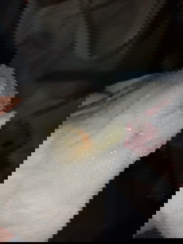 กระตุ้นปากมดลูก