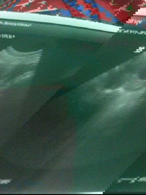 Usg usia 8week baru keliatan putih telur