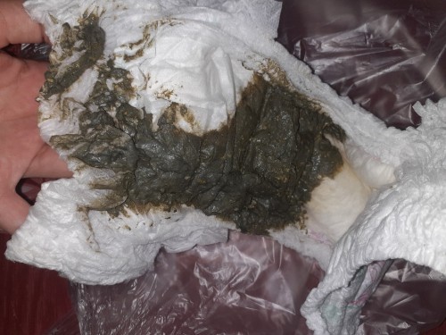 น้องขี้เเบบนี้ปกติม่ค่ะน้องกินนมผงค้ะกินซีรีเล้กด้วยค่ะ