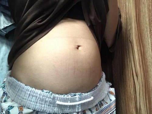 คนท้อง มีหน้าท้อง พุง?