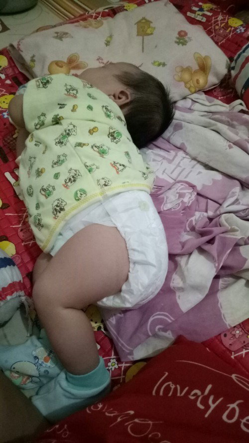 babyq umur 3 minggu sdh bisa miring