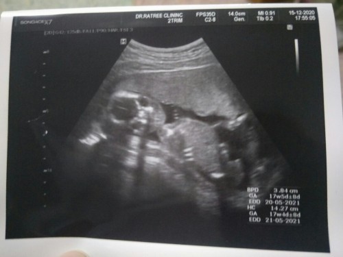 สอบถามค่ะ ในรูปคือน้องหันหน้าออกมาเหรอคะ?