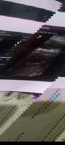 bunda aku mau tanya aku hamil Minggu lalu 6minggu dan aku USG kata drnya masih terhim apa kah begitu