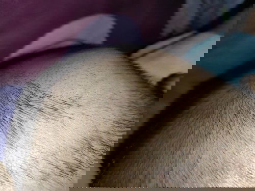 Ini benjolan apa y? Tdk kenyal atwpun keras saat ditekan. Si anak jg tdk kesakitan. Mohon share bund