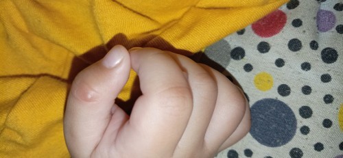 gatal gatal