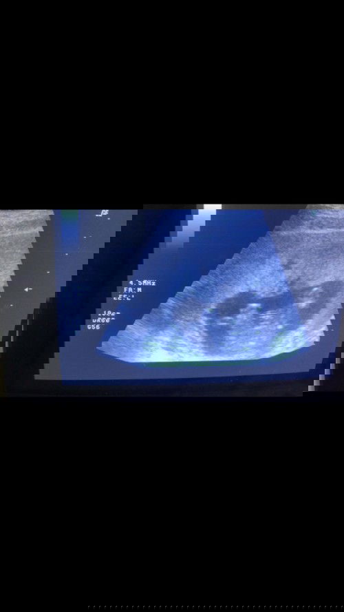 แม่ๆช่วยดูทีคะ