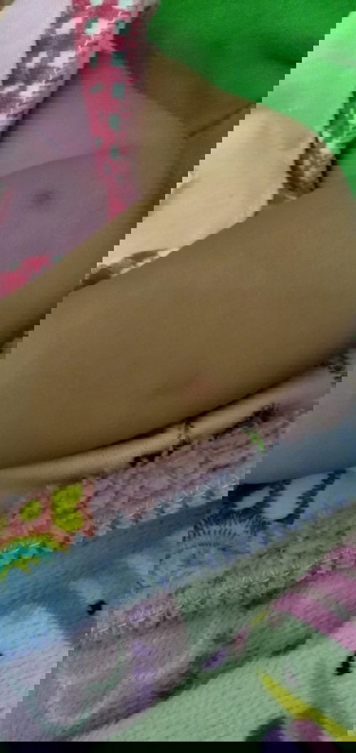 Bekas gigitan nyamuk