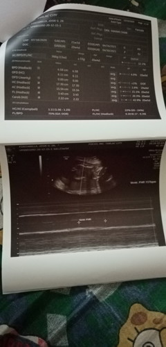 It's a boy