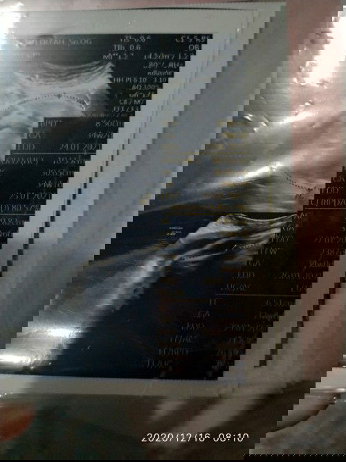 usia kehamilan seharusnya 32 wk tp diusg 33-34?