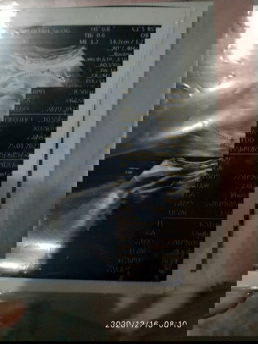 usia kehamilan seharusnya 32 wk tp diusg 33-34?