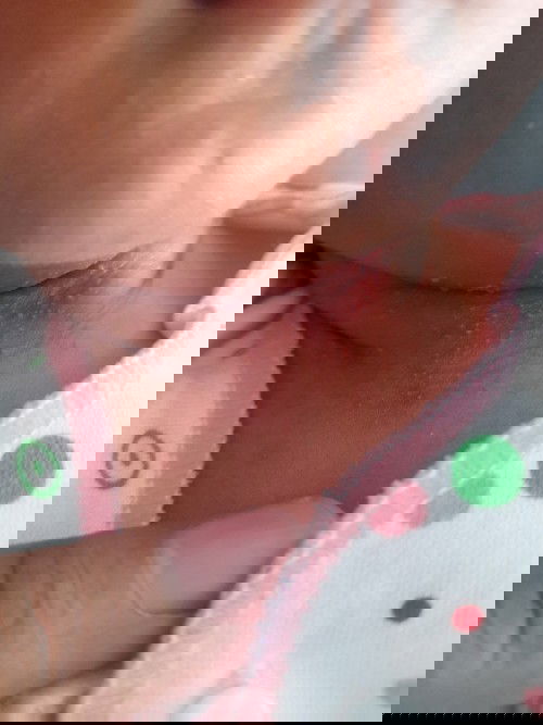 Biang keringet bayi baru lahir