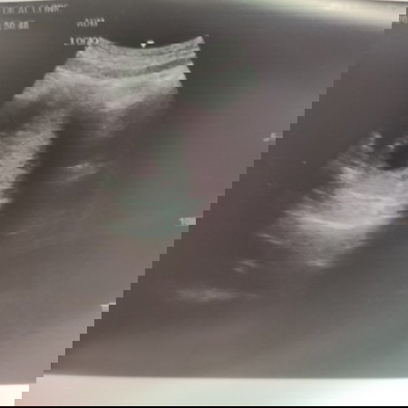 7 week scan normal?