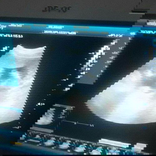 Hamil 16w tapi perut gak gede