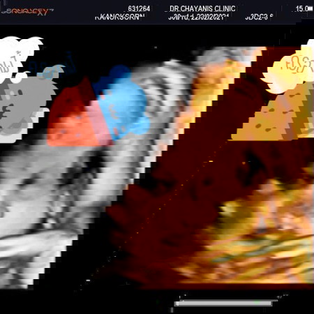 ลูกชายคนแรก