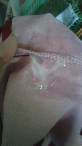 อยากสอบถามแม่ๆค่ะ
ว่าในรูปคือตกขาวหรืออะไรค่ะ
ท้องแรกค่ะ