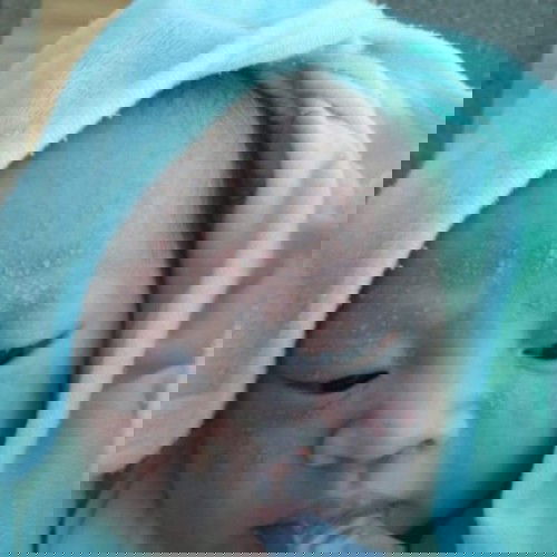 ลูกหน้าเป็นผื่น