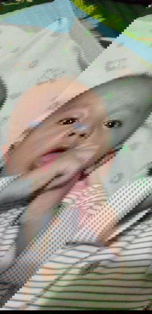 Rambut Rontok plus Cacian Anak saya Nafasnya Grok Grok