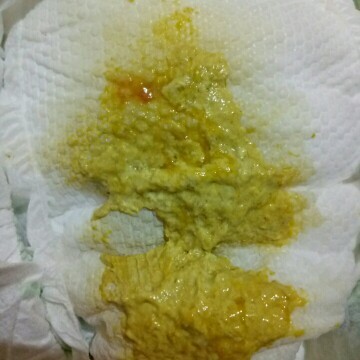 Poblema ko po ung poop ni baby