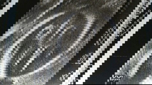 มีเเม่ๆท่านไหนเคยเป็นบ้างคะ