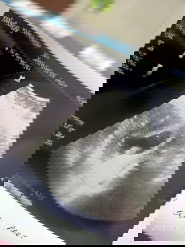 Baby no 3 tpi scan nmpk kecil dri date period