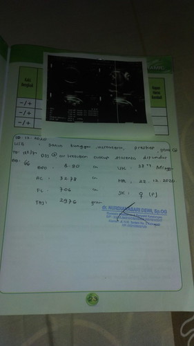 Hasil USG