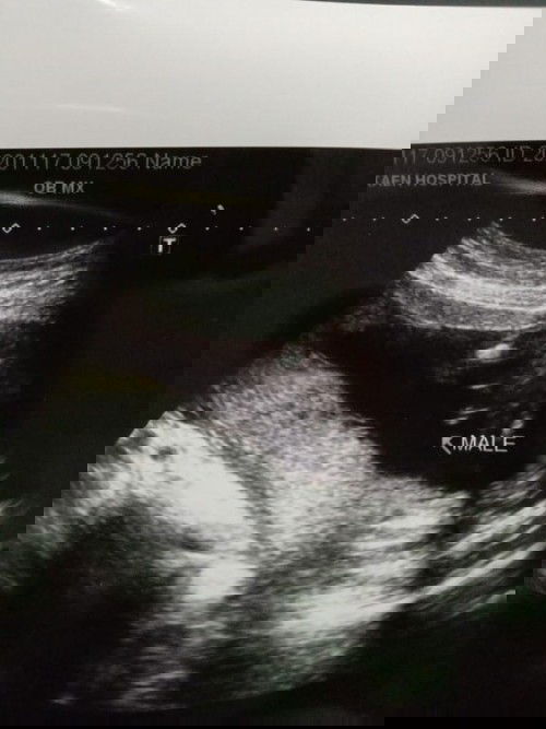 เเม่ๆคะ ดูเพศยังไงคะ