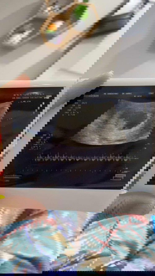 Gimana tanggapan bunda