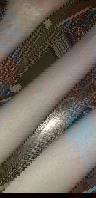 Nổi mẩn ngứa sau sinh