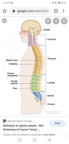 Spinal cord surgery giving birth