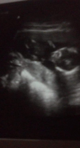 ช่วยดูเพศหน่อยค่ะ