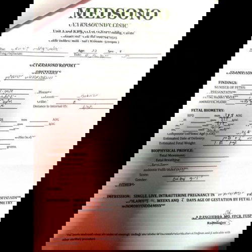 Need help ultrasound