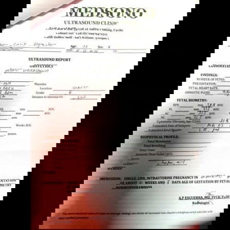 Need help ultrasound