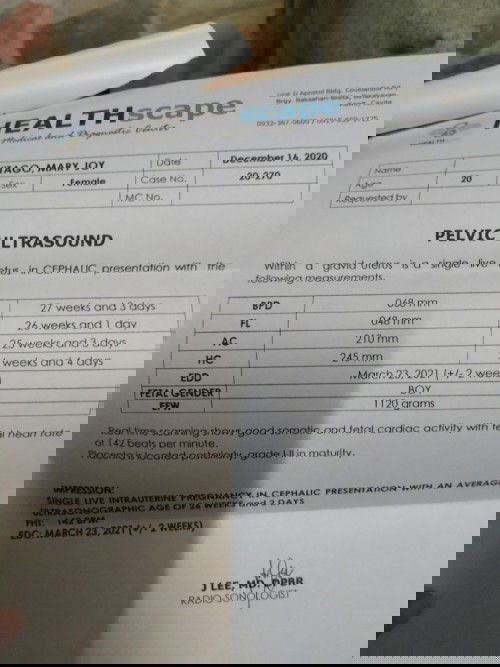 Ultrasound it's a boy!💙