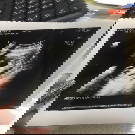 3เดือนดูเพศได้ไหม