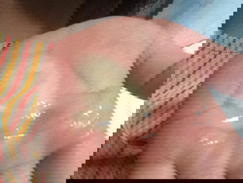 Lendir agak coklat atau kuning