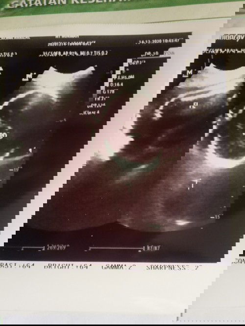 Sedih bimbang khawatir