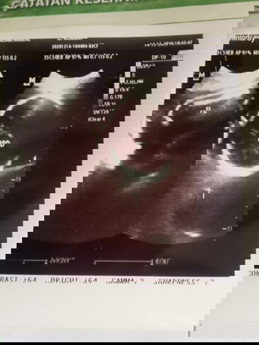 Sedih bimbang khawatir