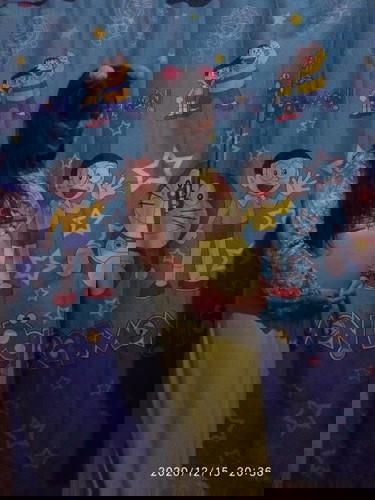 Apa wajar hamil tanpa streckmack jg ga bengkak kaki tapi sering kram kaki?