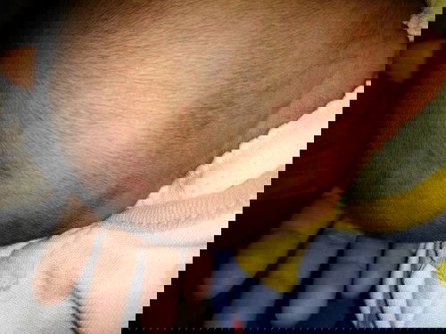 Biang keringat atau bukan?