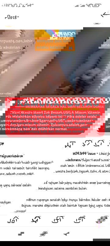 Pentingnya USG dan vitamin saat hamil