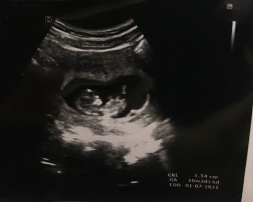 ท้องแรกค่ะ