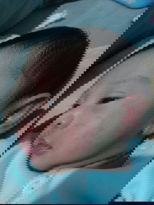 Bunda ada yang tau ini kenapa?