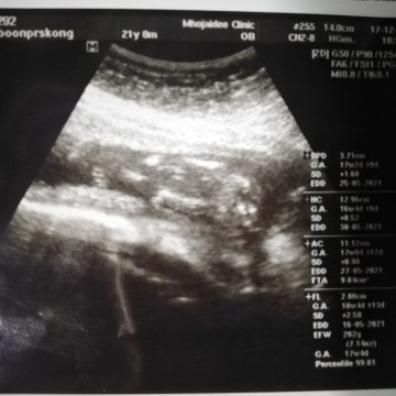 ช่วยดูหน่อยค้ะว่าญหรือช